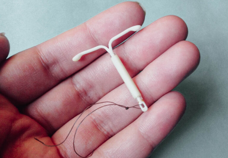 Mirena Intra Uterine Device IUD Insertion And Removal Collingwood 